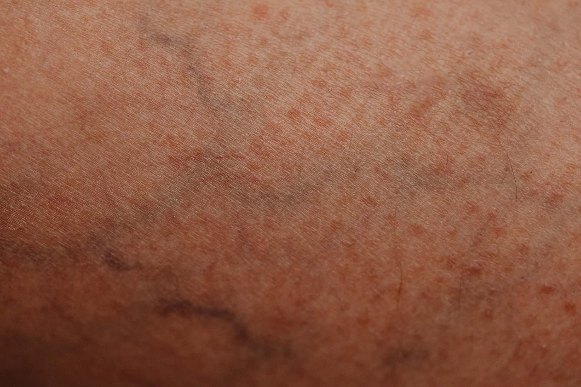 A close-up of skin texture