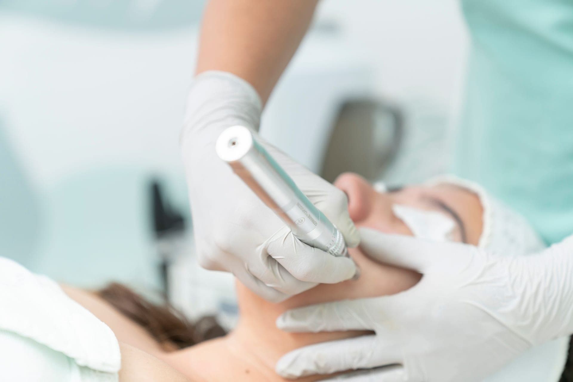 A gloved practitioner performing microneedling with a pen device