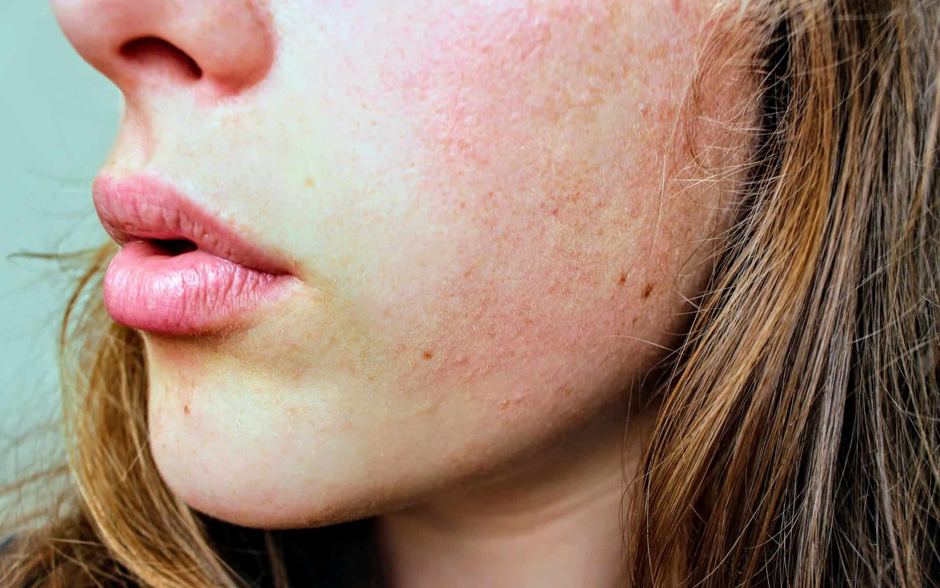A close-up of the skin on a woman's cheek